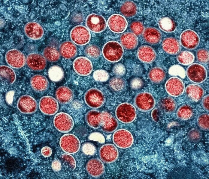 99393044-variola-dos-macacos-virus-monkeypox.-foto-niaid